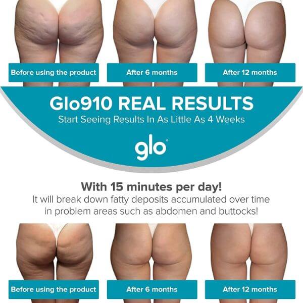 anti-cellulite before after