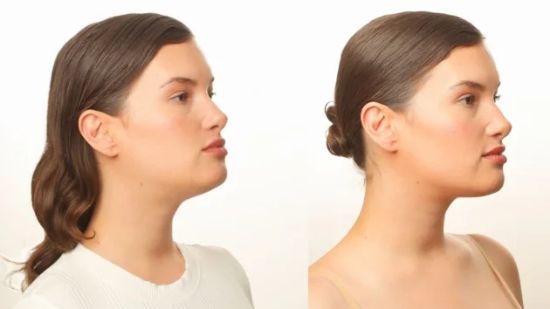 face-toning-device-before-after