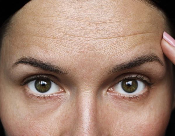 How to Reduce Forehead Wrinkles