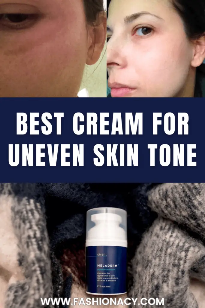 Best Cream For Uneven Skin Tone