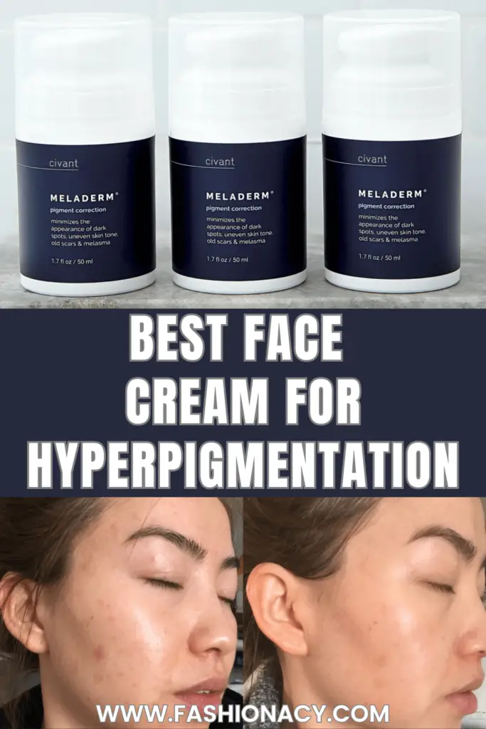 Best Face Cream For Hyperpigmentation