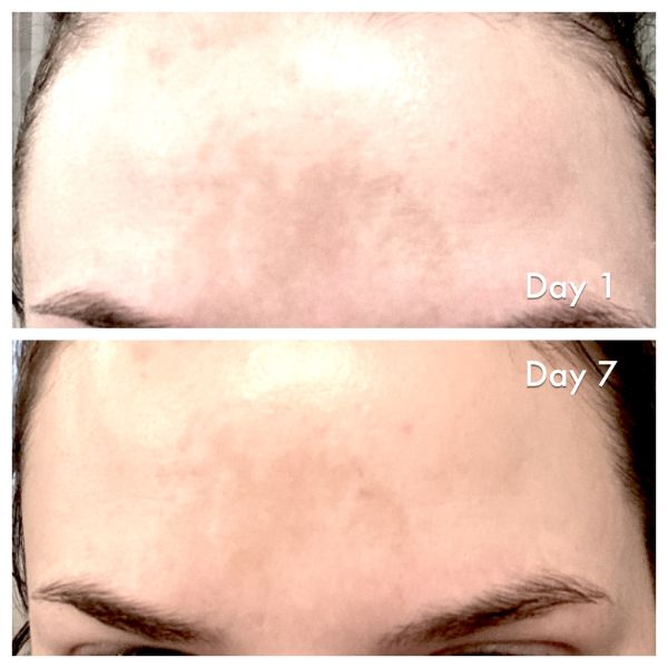 best-skin-brightening-cream-results