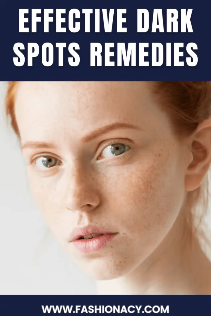 Dark Spots Remedies