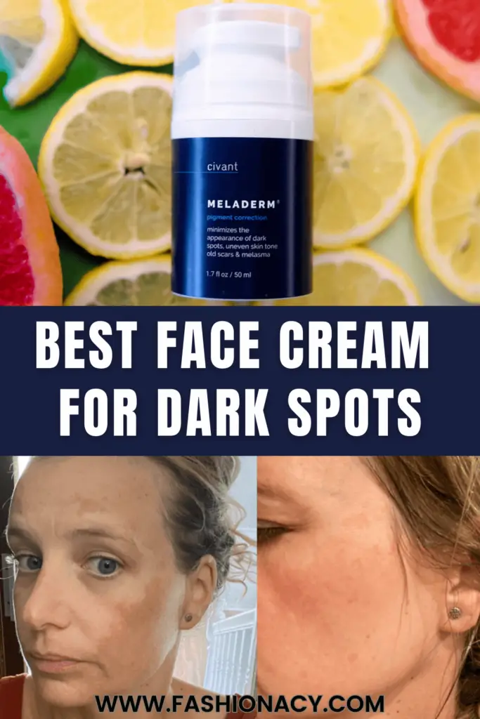 face-cream-for-dark-spots
