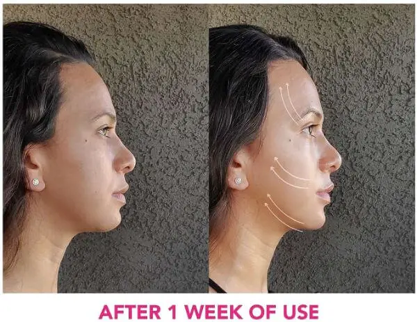Microcurrent Facial Before and After