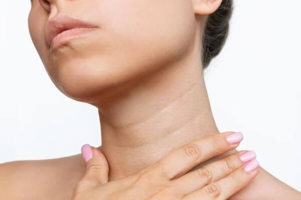 How To Get Rid of Neck Lines