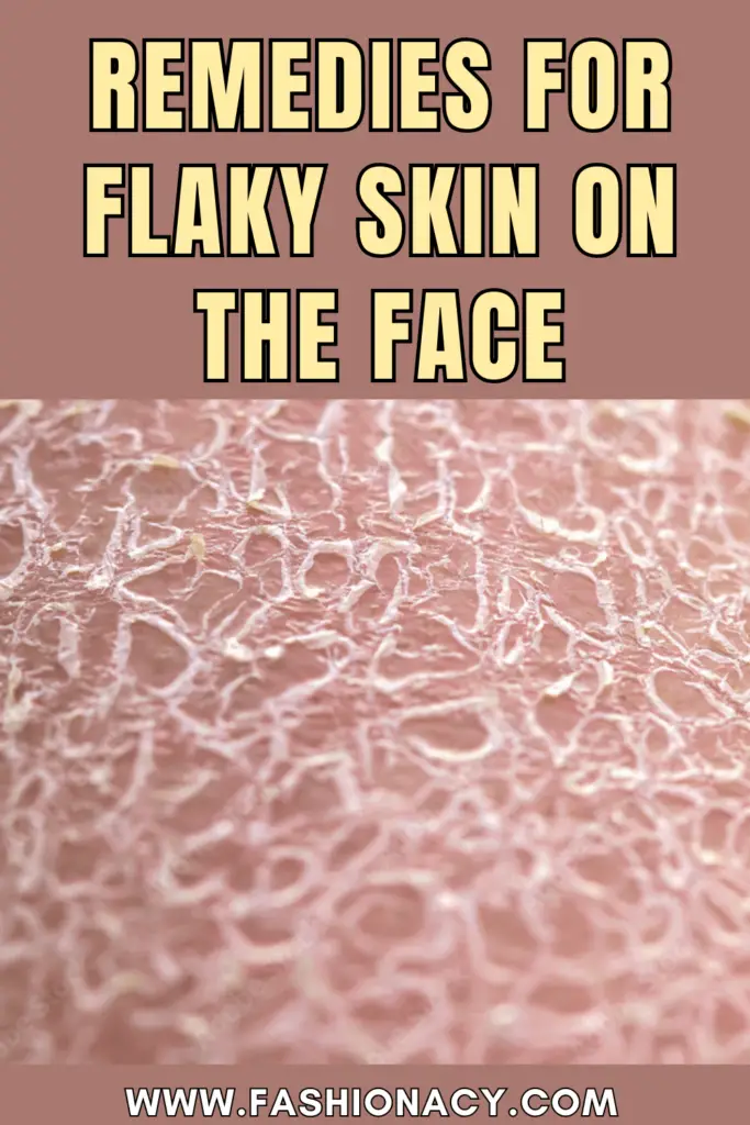 remedies for flaky skin on the face